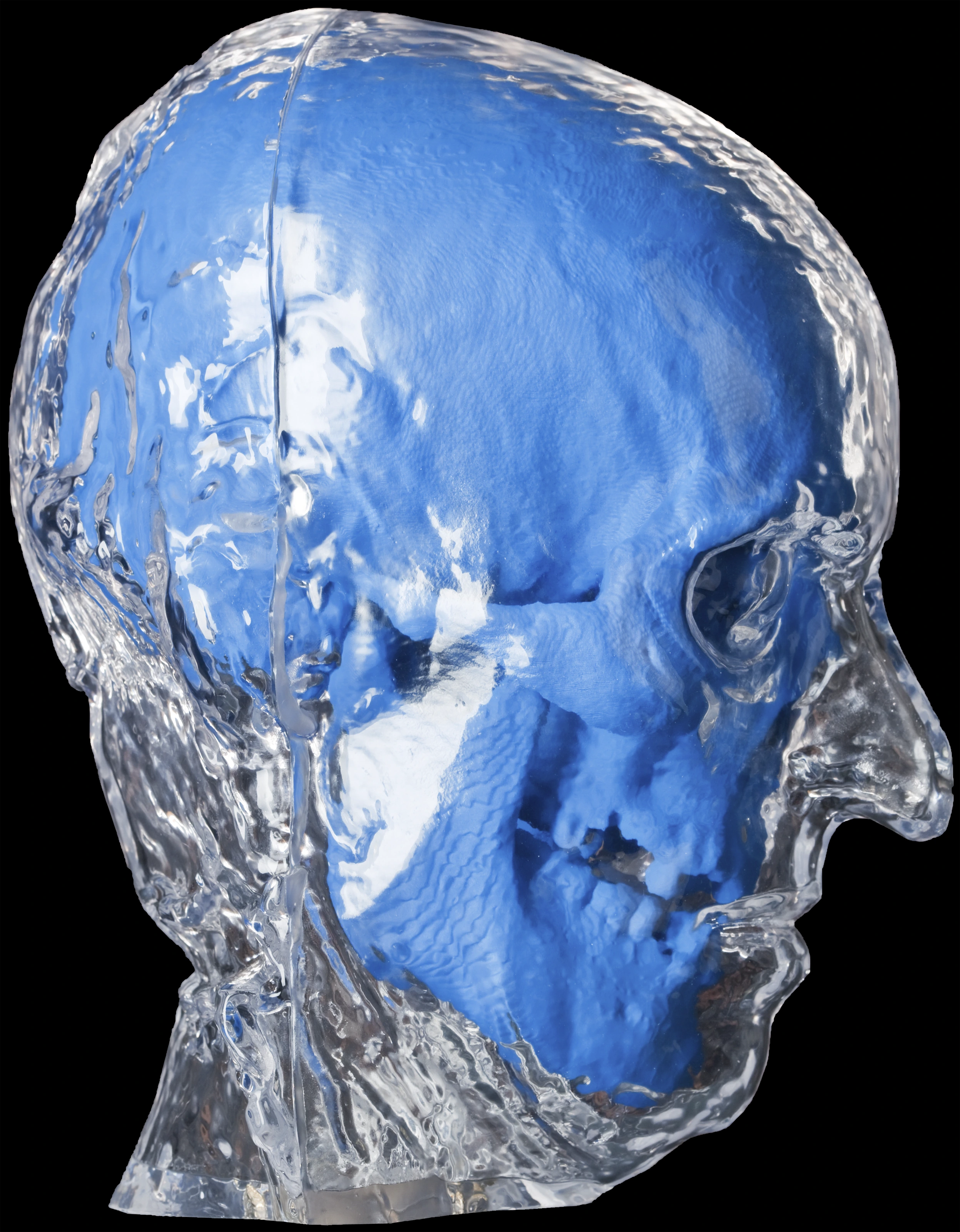 Seitenansicht des 3D-Drucks