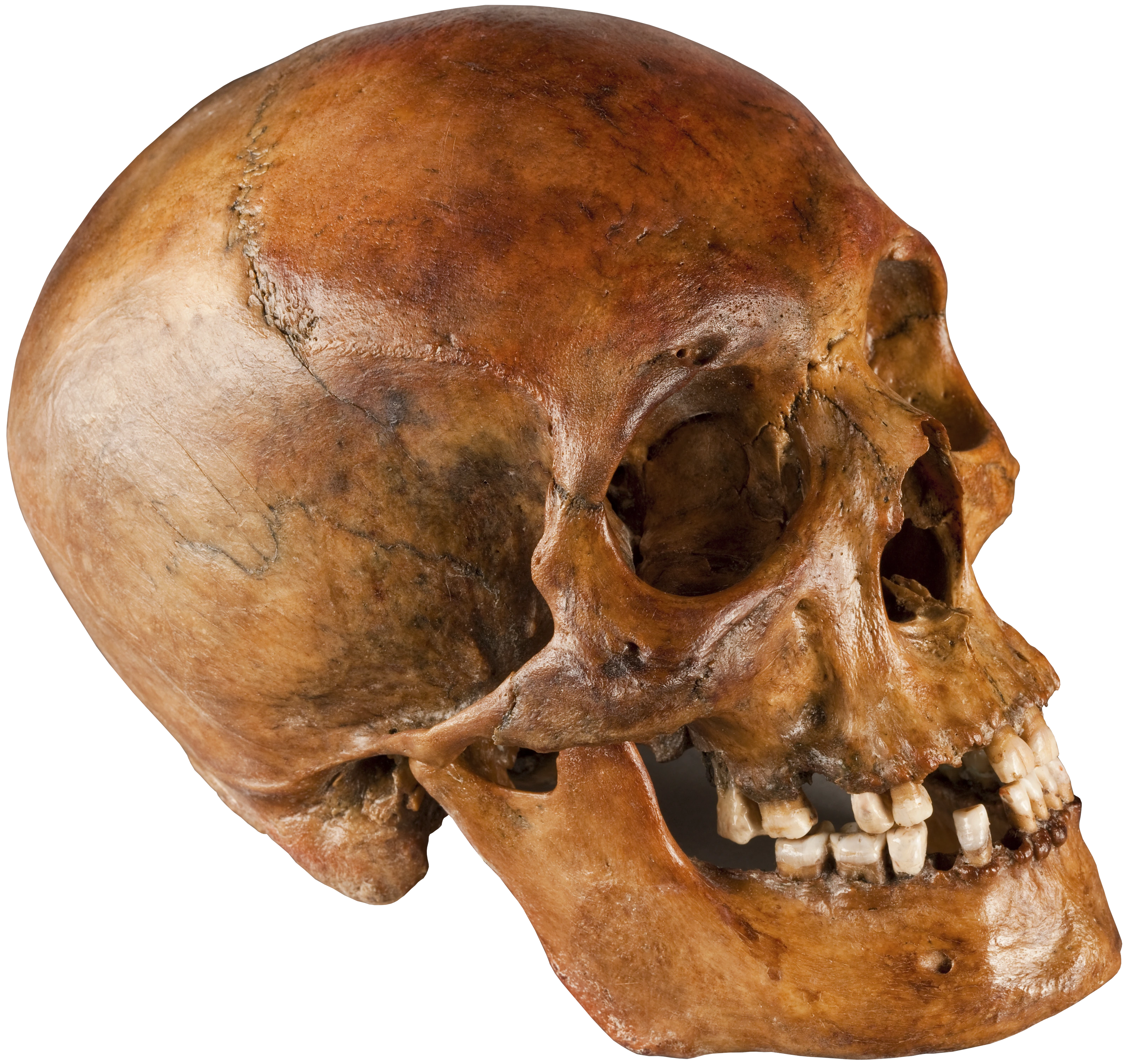 Schädel aus Schillers Sarkophag in der Fürstengruft (Schwabe-Schädel)